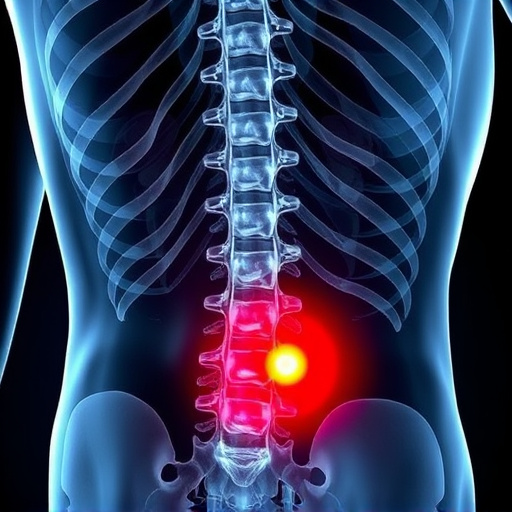 herniated disc