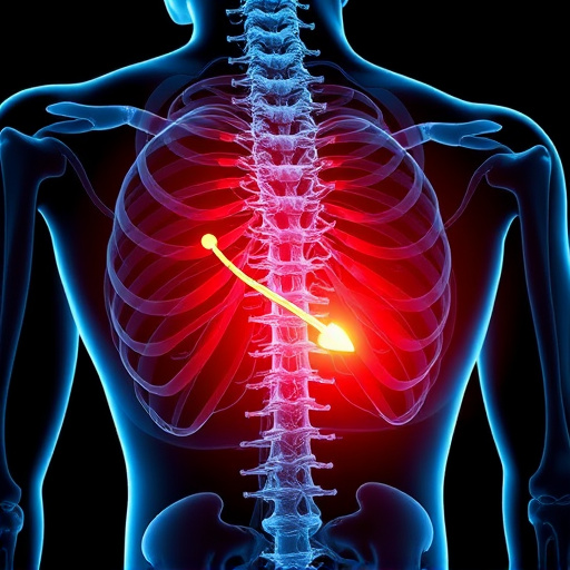 herniated disc