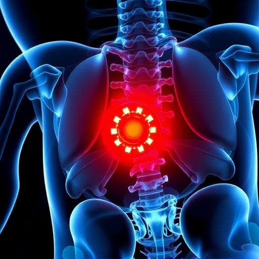 herniated disc
