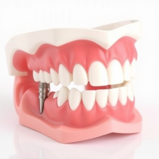 implant dentures