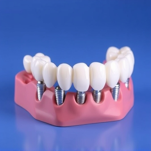implant dentures