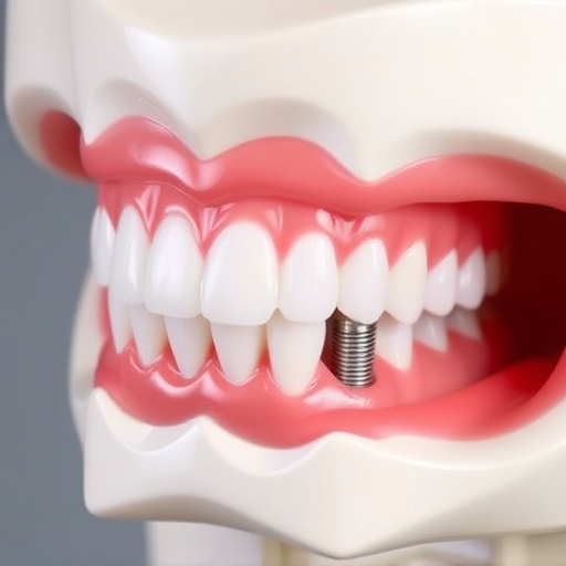 implant dentures