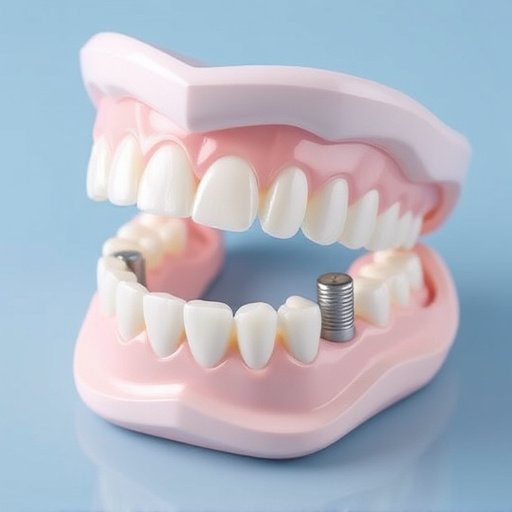 implant dentures
