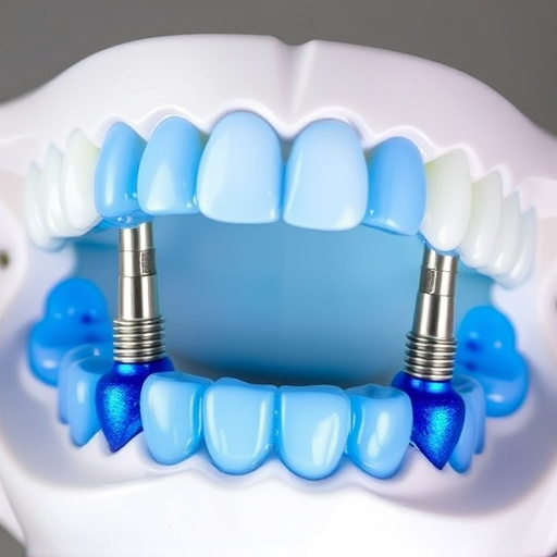 implant dentures