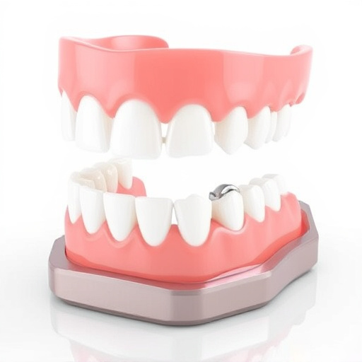 implant dentures