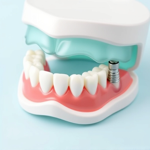 implant dentures