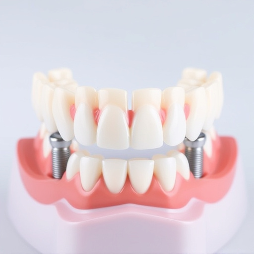 implant dentures