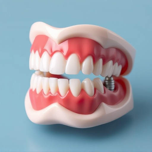 implant dentures