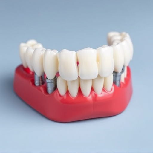 implant dentures