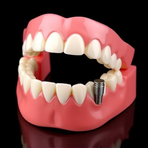 implant dentures