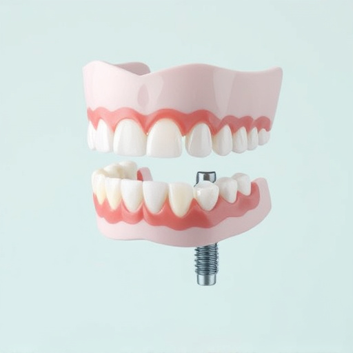 implant dentures