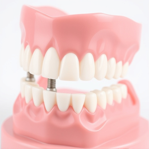 implant dentures