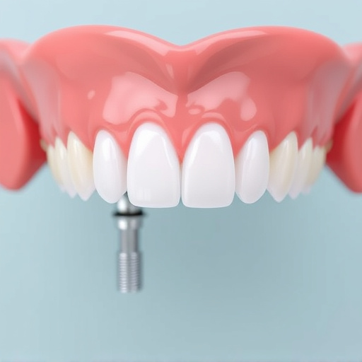 implant dentures