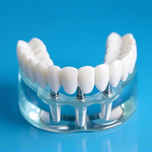 implant dentures