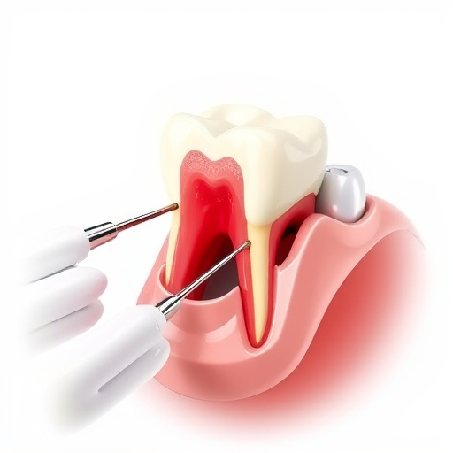 tooth extraction