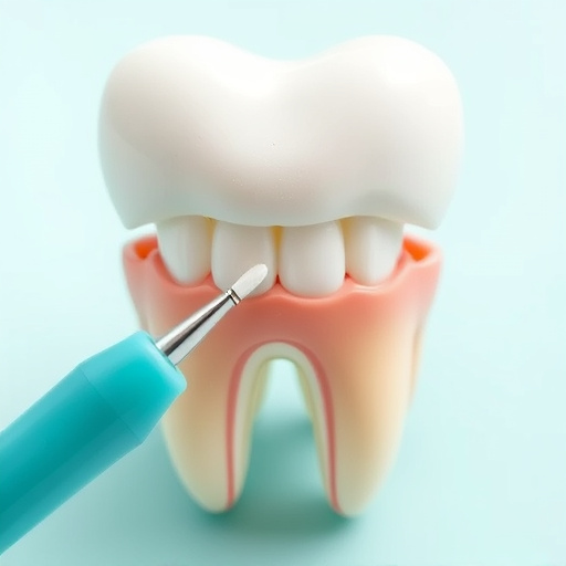 tooth fillings