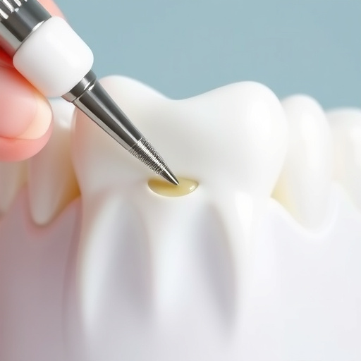 tooth fillings