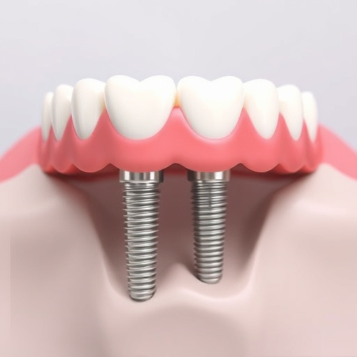 dental-implants-640x480-12876264.jpeg