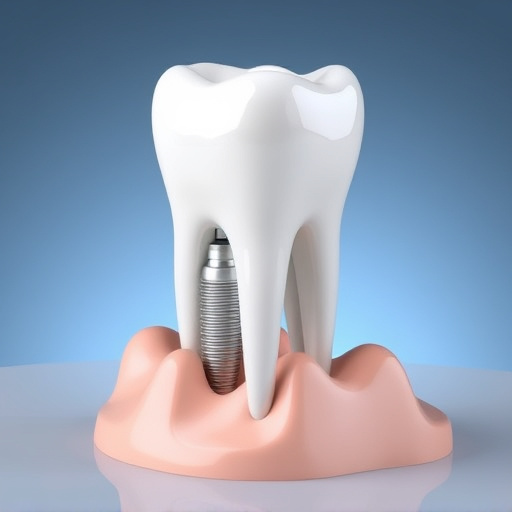 dental implants
