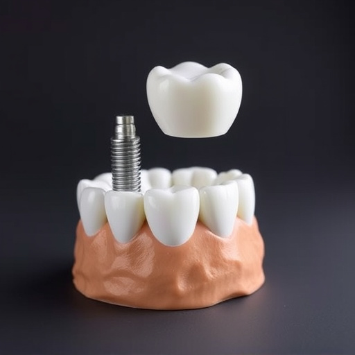 dental implants