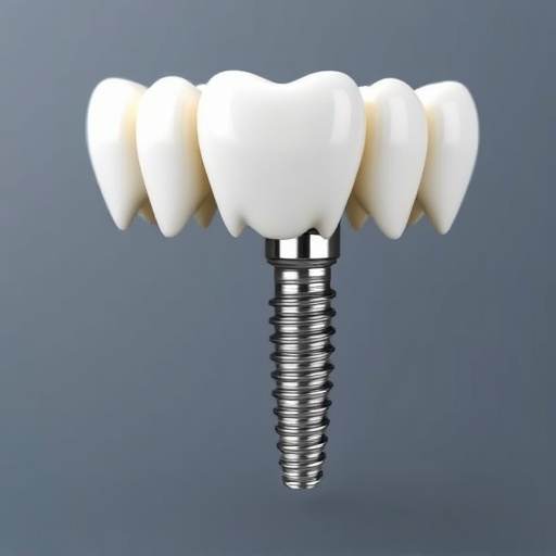 dental implants