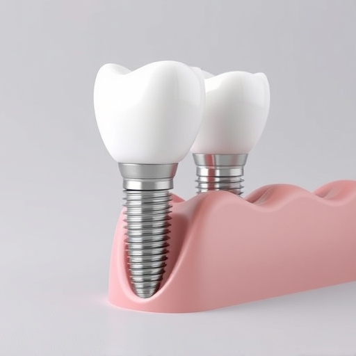 dental implants