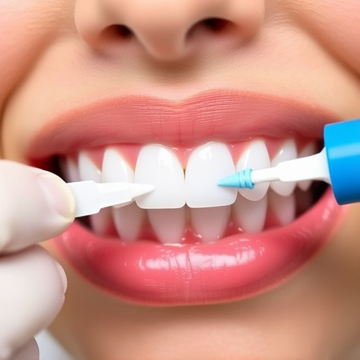 dental sealants