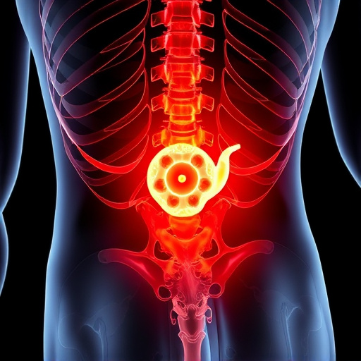 herniated disc