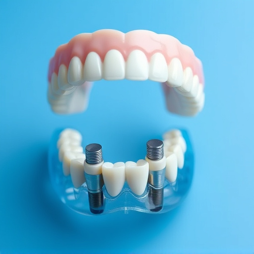 implant dentures