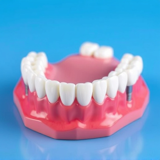 implant dentures
