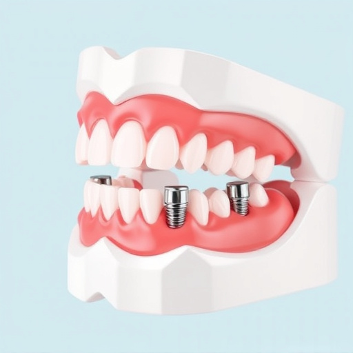 implant dentures