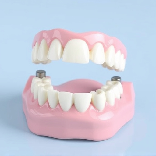 implant dentures