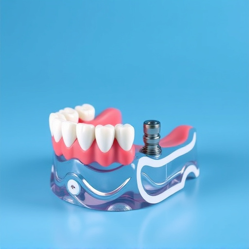 implant dentures