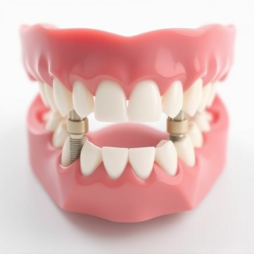 implant dentures