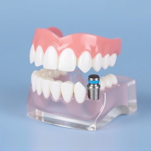 implant-dentures-640x480-52144193.jpeg