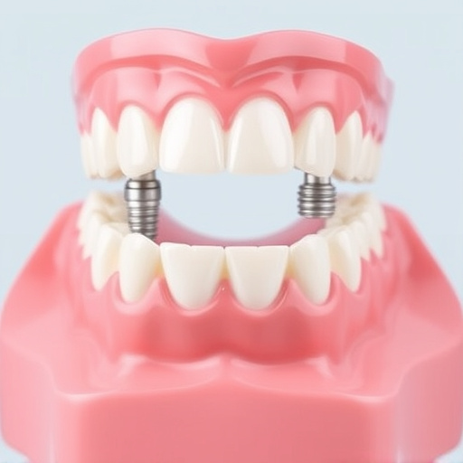 implant dentures