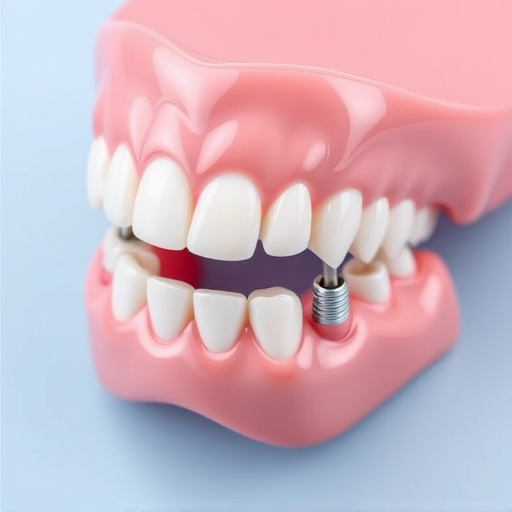 implant dentures