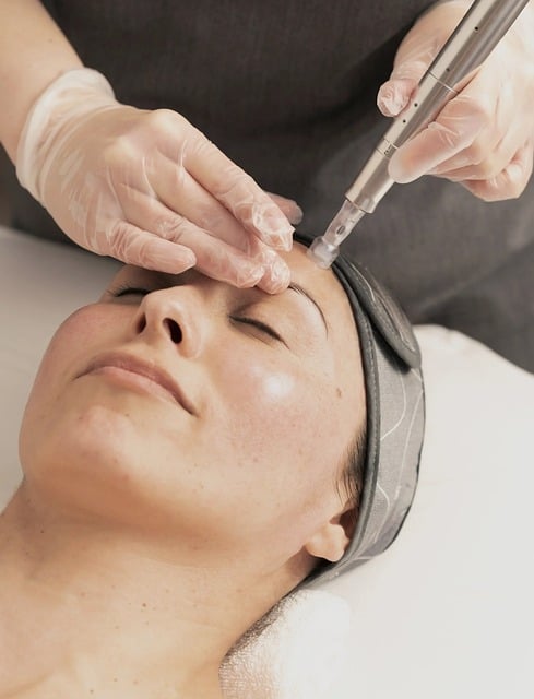 Microdermabrasion