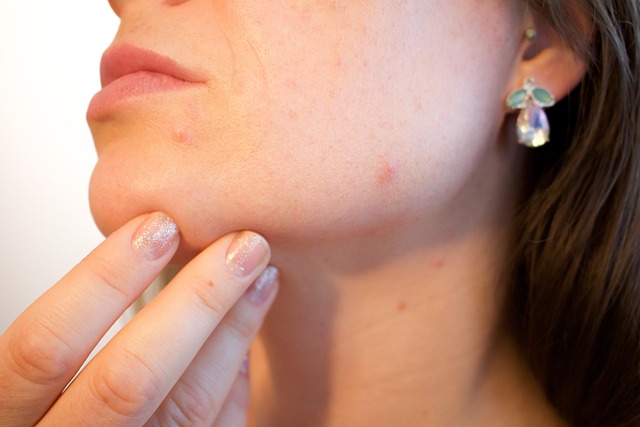 Scar treatment
