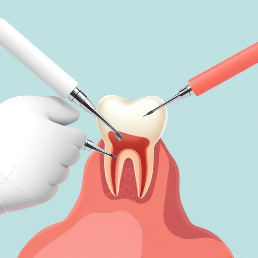 tooth extraction