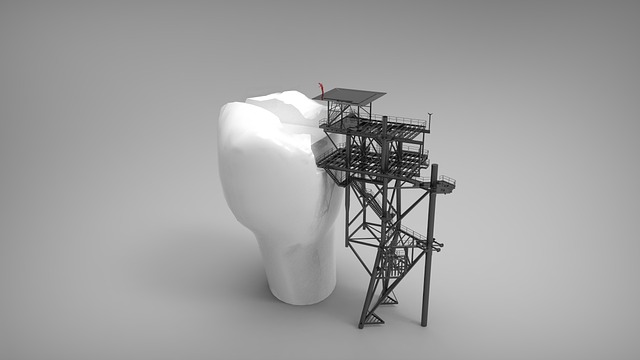 tooth fillings